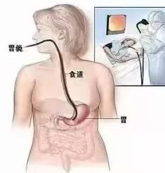 “胃”爱前行，健康“肠”住——无痛胃肠镜之“无痛”知多少
