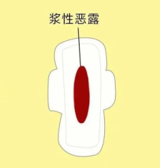 产后健康的