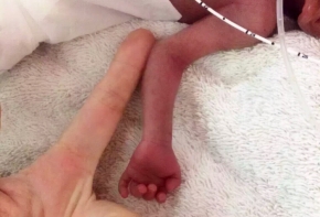 生命回响，信任无疆——记四川省妇幼保健院天府院区新生儿科与“早到天使”安安的三年之约